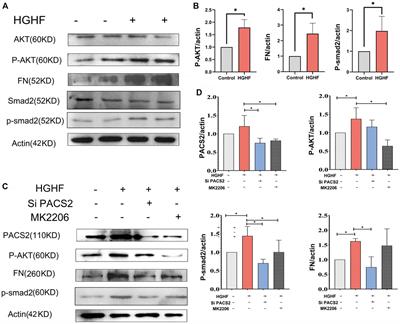 AKT/PACS2 Participates in Renal Vascular Hyperpermeability by Regulating Endothelial Fatty Acid Oxidation in Diabetic Mice